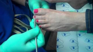 The proper way to trim your toenails [upl. by Jeramie]