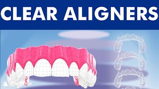 INVISALIGN  Orthodontic treatment with CLEAR ALIGNERS © [upl. by Chap]