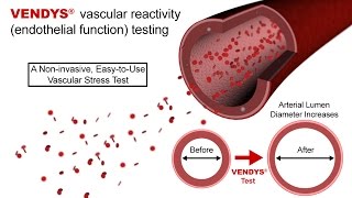 VENDYS  Endothelial Function Measurement Explained [upl. by Atinyl]