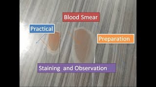 Blood Smear preparation staining and observation [upl. by Ahseiyn]