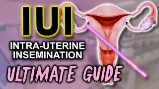 Fertility pills to get pregnant  TTC  InfertilityTV [upl. by Duleba27]