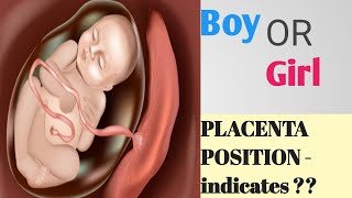 Placenta Positions During Pregnancy  Baby Gender Prediction  Anterior or Posterior Placenta [upl. by Bowerman543]