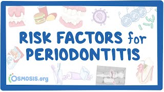 Risk Factors for Periodontitis [upl. by Basia]