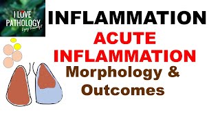 Myocardial InfarctionHeart Attack Causes Pathogenesis Signs amp Symptoms Diagnosis amp Treatment [upl. by O'Connell42]