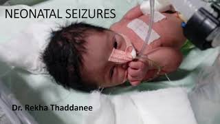 Neonatal Seizures  Pediatrics [upl. by Vidovik]