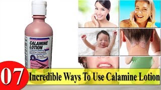 7 Incredible Ways To Use Calamine Lotion [upl. by Nrubua]