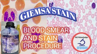 BLOOD SMEAR amp GIEMSA STAIN PROCEDURE [upl. by Blim]