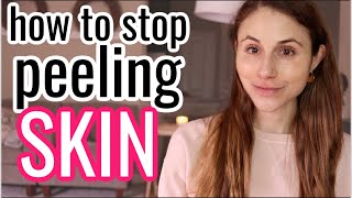 How to STOP PEELING SKIN Dr Dray [upl. by Gelasias612]